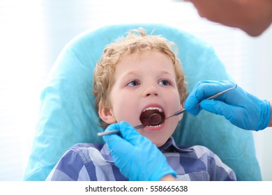 Close-up Of Little Boy Opening His Mouth Wide During Inspection Of Oral Cavity By Dentist.