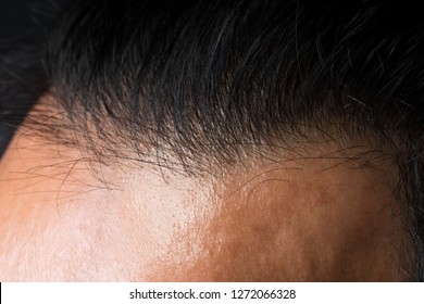 Imagenes Fotos De Stock Y Vectores Sobre Thin Root Shutterstock