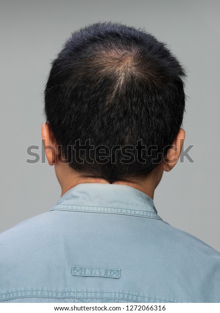 Closeup Macro Portrait Male Hair Head Stock Image Download Now