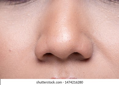 Closeup Macro Portrait Of Woman Nose Skin Acne, Young Female Turn Side Face. Body Part Of Fashion Make Up, Studio Lighting