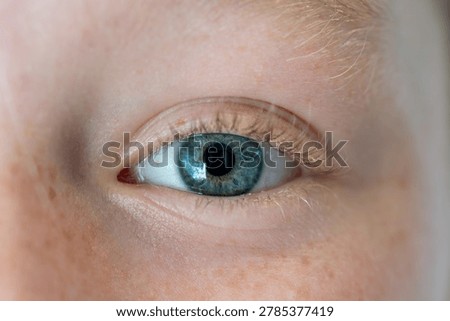 Close-up macro view of a light-colored human eye with freckles
