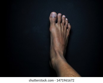 Black Teen Feet Pics