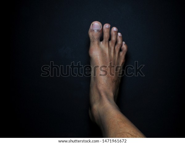 Black male feet pretty Celebrity Feet