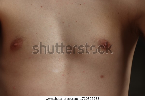 Nipples Closeup Pics
