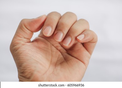  Closeup Of Man  Finger Nail 