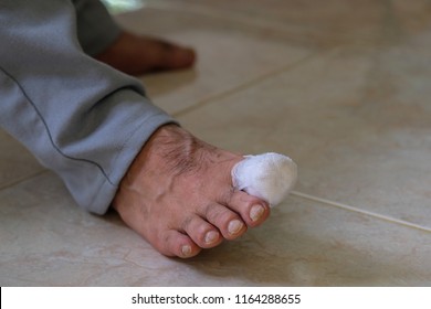 Closeup Of Man Right Foot With A Wounded Big Toe Healed With Band Aid For Medical Care. 