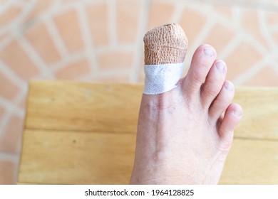 Closeup Of Man Right Foot With A Wounded At Big Toe. And Wrap A Bandage To Protect The Big Toe.