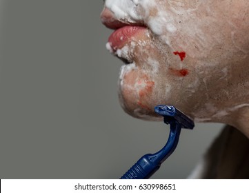 Closeup Man Shaving Razor Burn With Blood. Man Shaving Using Razor With Cream Foam. Guy Removing Face Beard Hair. Skin Care And Hygiene. Man Was Injured By A Razor