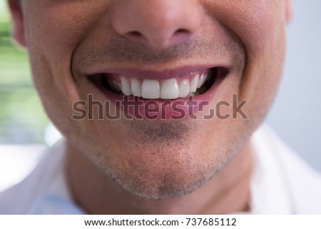 Closeup of man smiling at dentist office