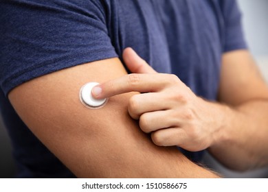 Close-up Of A Man Testing Glucose Level With A Continuous Glucose Monitor On His Arm