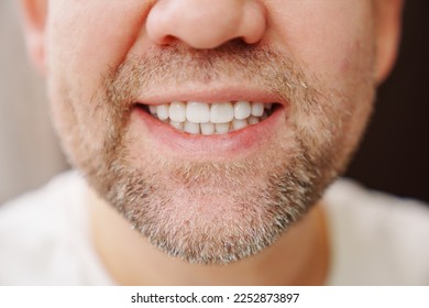 close-up. the man's mouth with stubble smiles and shows white teeth. the concept of dental services, whitening and veneers. - Powered by Shutterstock