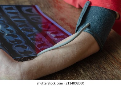 Close-up Of A Man's Shoulder With A Blood Pressure Cuff On. An Adult Male Holding A CT Scan Of His Lungs. Measuring Blood Pressure At Home. Selective Focus.