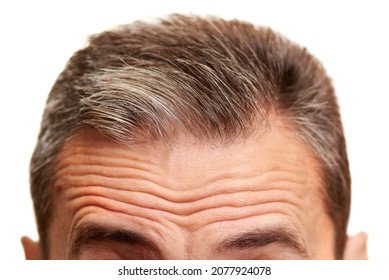 Close-up Of A Mature Men Forehead With Wrinkles.