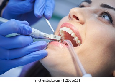 close-up medical dentist procedure of teeth polishing. Dentist making professional teeth cleaning female young female patient at the dental office. Close-up plan