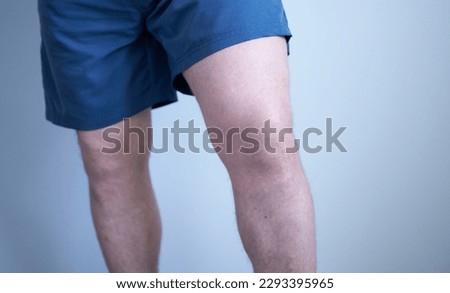 Close-up of men's legs in shorts. Knee close-up. Knee injury.