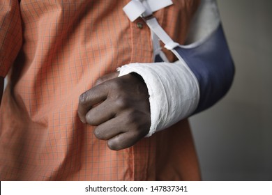 Closeup Midsection Of A Man With Broken Arm In Cast