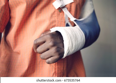 Closeup midsection of a man with broken arm in cast - Shutterstock ID 673535764