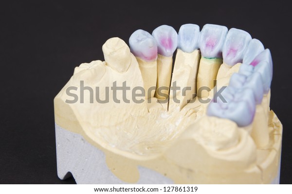 dental circular contour definition dental circular contour definition