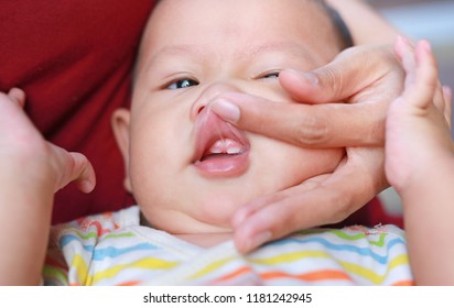 Close-up Mother Hands Open Baby Mouth To Examine First Teeth. Infant Primary Tooth.