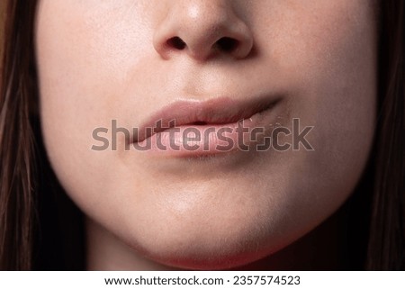 close-up of the mouth of a girl with hemiparesis, Bell's palsy. Forced smile across half face. Muscles paralyzed by inflammation of the facial nerve