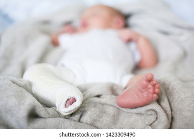 Closeup Of Newborn Little Baby With Leg In A Cast - Clubfoot