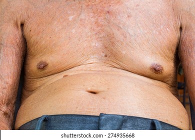 Closeup Old Man Chest And Big Belly With Texture Of Wrinkle Skin