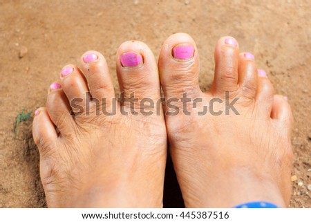 Close-up old woman's foots cracked with tan skin and pink nails standing on cement background, healthy concept.