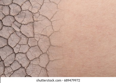 close-up on dry woman skin texture with dry soil