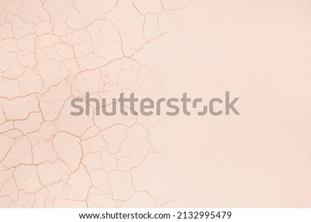 Close-up on dry woman skin texture with dry dessert. Skin care concept.