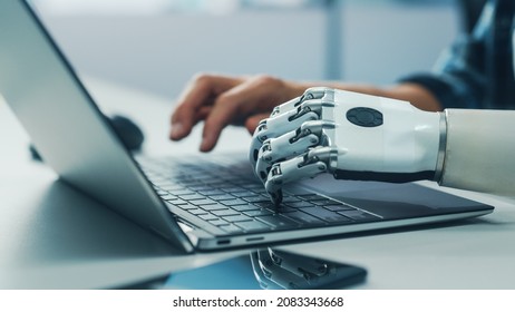 Close-up on Hands: Person with Disability Using Prosthetic Arm to Work on Laptop Computer. Specialist Swift and Natural Use of Thought Controlled Body Powered Myoelectric Bionic Hand. - Shutterstock ID 2083343668