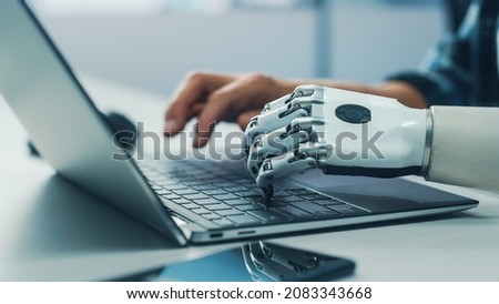 Close-up on Hands: Person with Disability Using Prosthetic Arm to Work on Laptop Computer. Specialist Swift and Natural Use of Thought Controlled Body Powered Myoelectric Bionic Hand.