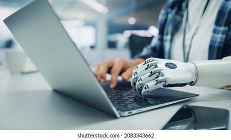 Close-up on Hands: Programmer With Disability Using Prosthetic Arm to Work on Laptop Computer. Specialist Swift and Natural Use of Myoelectric Bionic Hand To Type Code for Software - Shutterstock ID 2083343662