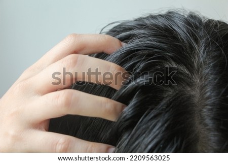 Close-up on head of Asian people have long black hair, having problems with greasy oily hair,  showing scalp, scratching herself, dandruff problem.