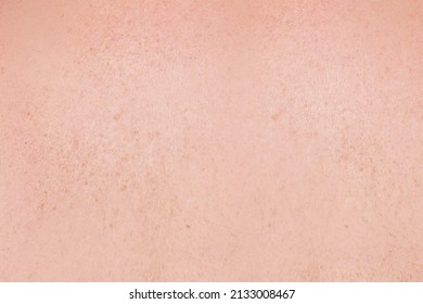 Close-up On Light Skin Freckles Texture. Skin Care Concept. Light Skin Freckles Complexion.