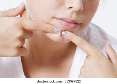 Closeup on teenager pimple (acne)