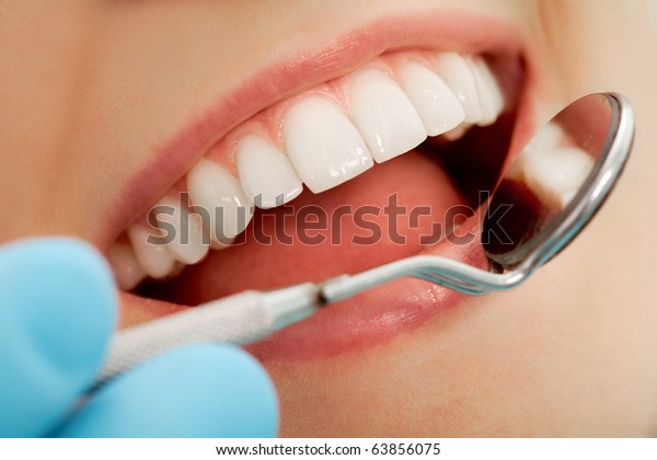 Closeup Open Mouth During Oral Checkup Stock Photo Edit Now 638