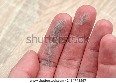 Close-up of palm with dust on fingers
