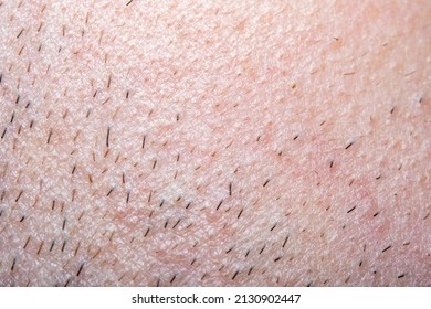 Close-up of a part of a man's face. Skin and slightly regrown stubble. Photo of beard grooming and shaving in soft focus at high magnification. - Shutterstock ID 2130902447