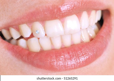 Close-up of patient s open mouth with a diamond tooth - a series of DENTAL related pictures.