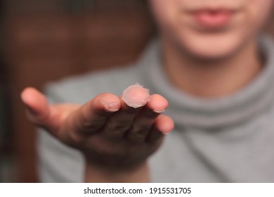 Closeup Of A Person Applying Vaseline (petroleum Jelly). Concept Of Slugging - Korean Skin Care Trend.