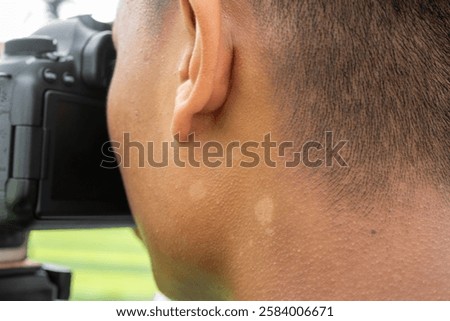 Close-up of a person's ear and neck while holding a DSLR camera with tinea versicolor in pityriasis versicolor, highlighting skin texture and camera detail in an outdoor setting.
