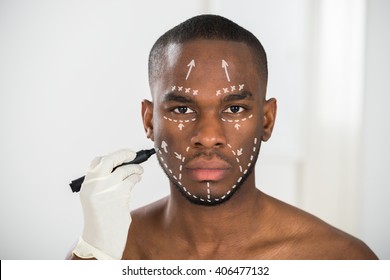 Close-up Of Person's Hand Drawing Correction Lines On African Man's Face