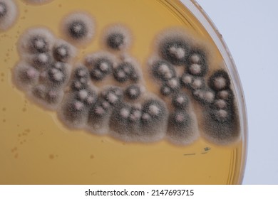 CLOSEUP PHOTO OF BACTERIA AND FUNGI GRWOTH ON AGAR MEDIA IN A PLASTIC PLATE