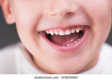 Closeup photo of boy mouth smiling. Dental kids hygiene background. - Powered by Shutterstock