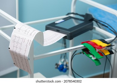 Close-up photo of an electrocardiograph printing out the results of a cardiogram during a doctor's appointment at the clinic
