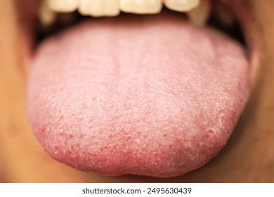 Close-up photo of a man sticking his tongue out, showing the detailed papillae on the tongue's surface. Concept for mouth and dental health