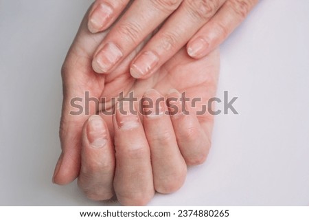 close-up photo of nails with white stripes. Lack of vitamins and minerals in the organism. Isolated on a white background