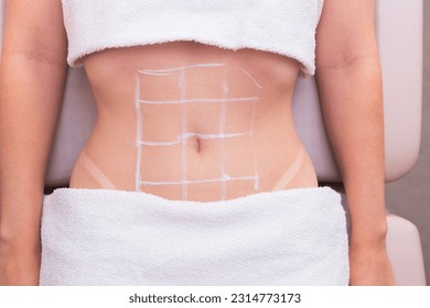 close-up photo of a woman's belly, photo of aesthetics, procedures on the abdomen. beauty clinic. ozone application, ozone therapy, enzymes, slimming. weight loss. - Shutterstock ID 2314773173
