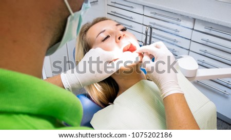 Closeup photo of young woman open mouth for theeth checkup