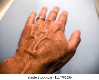 A Closeup Photograph Of A Caucasian Male Hand With A Sweaty Hand Extended Outward With Palm Down With Sweat Drops Beading On Back Of Hand And Raised Veins With Blue Yoga Mat Beyond.